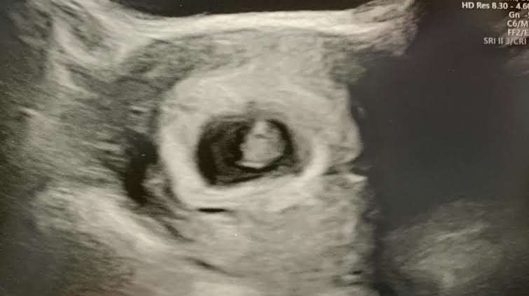 First Ultrasound